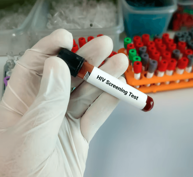 Hiv Test