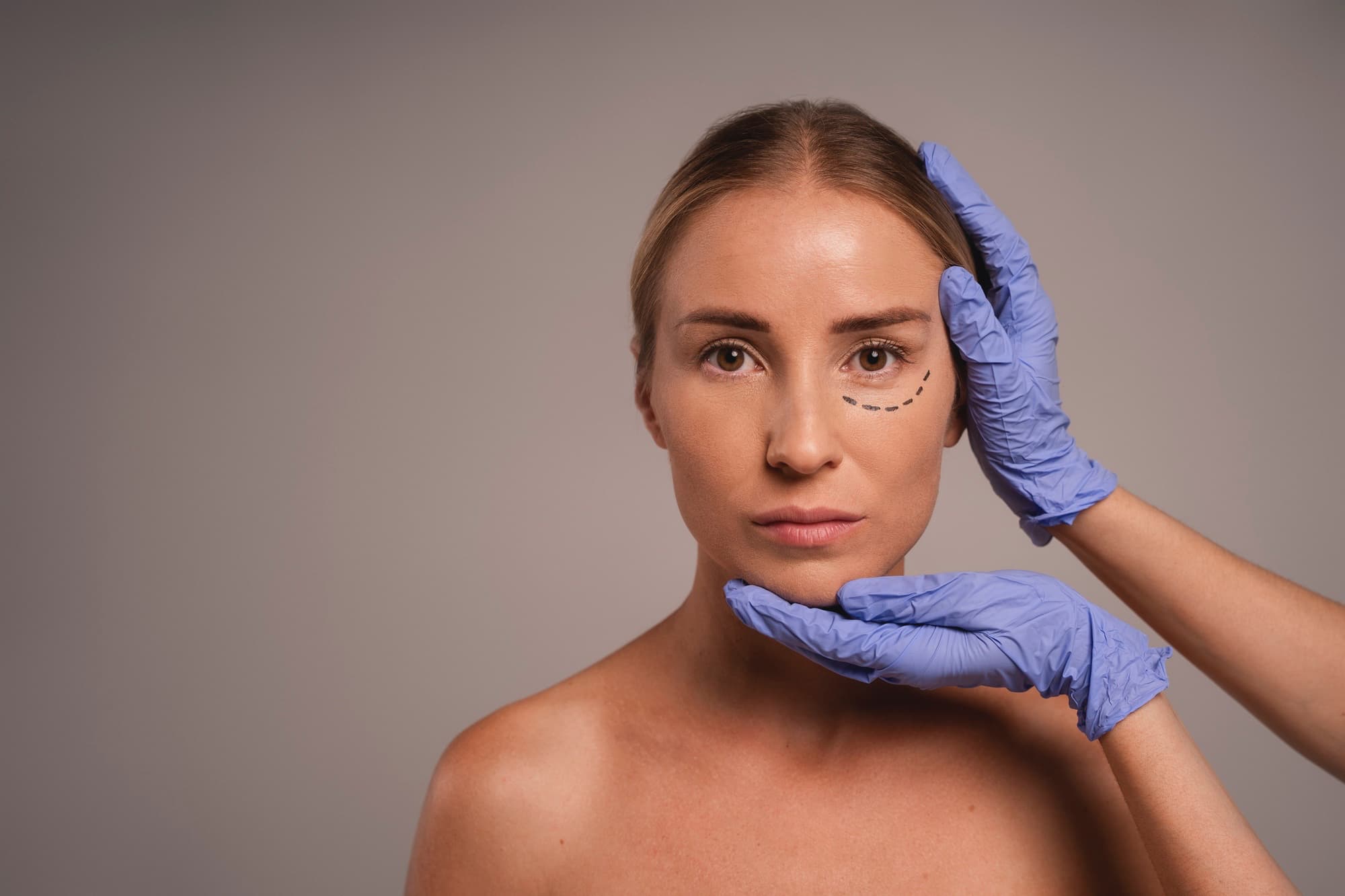 Blepharoplasty