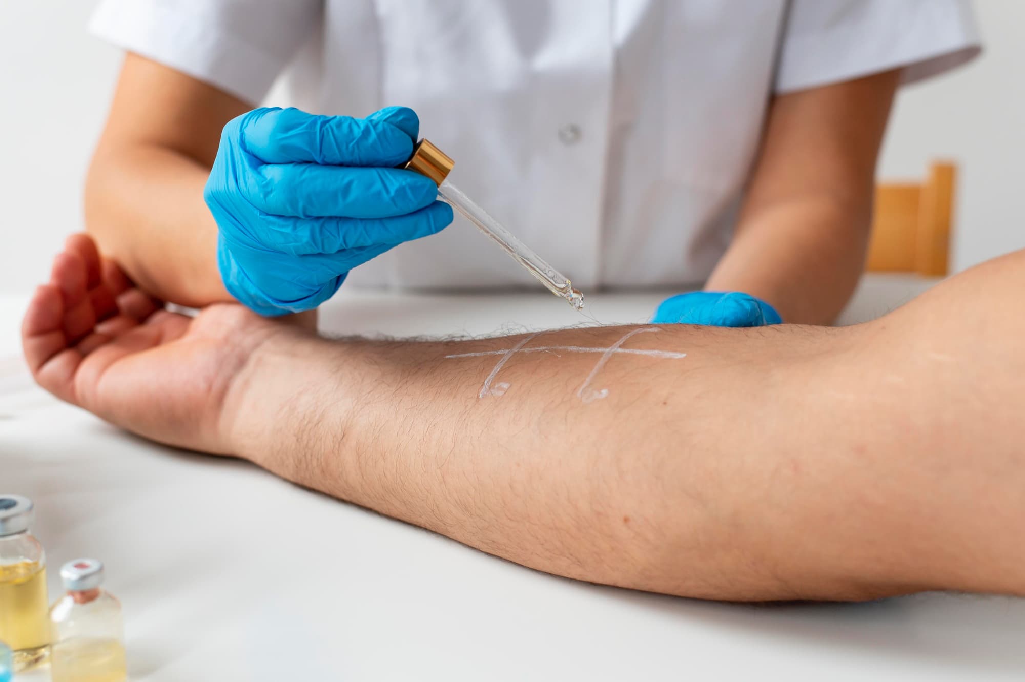 Scar Revision