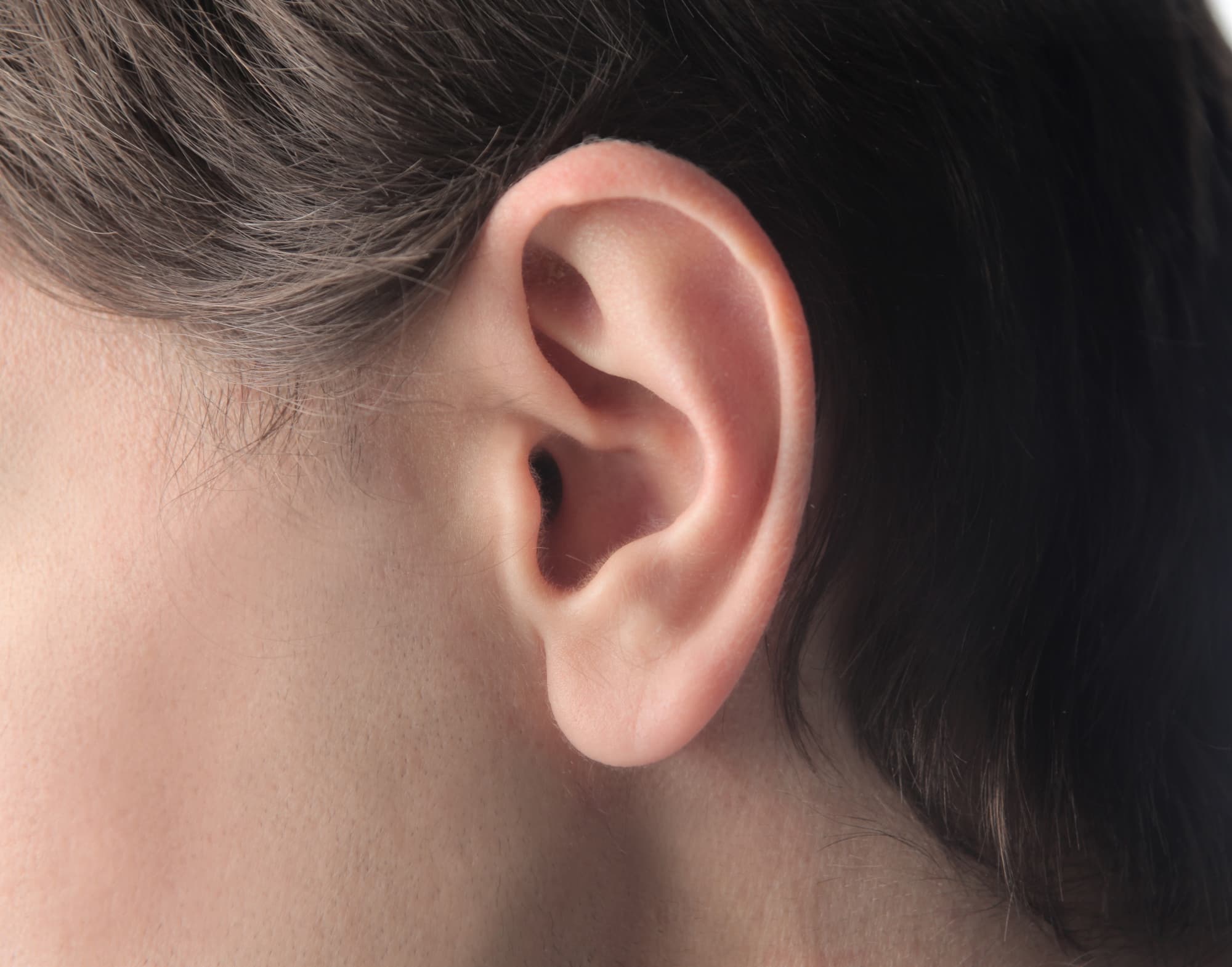 Earlobe Repair
