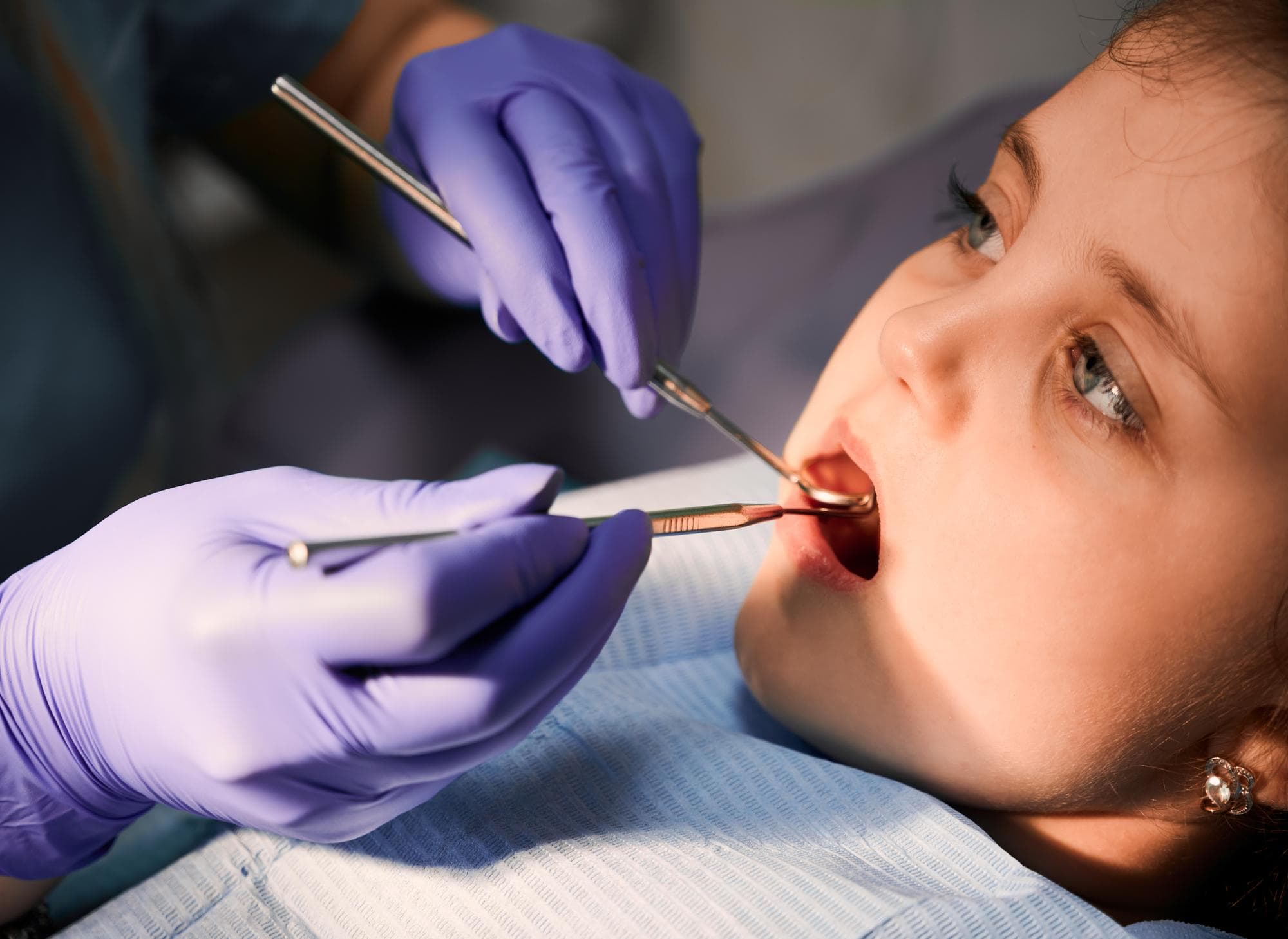 Tongue tie assessment